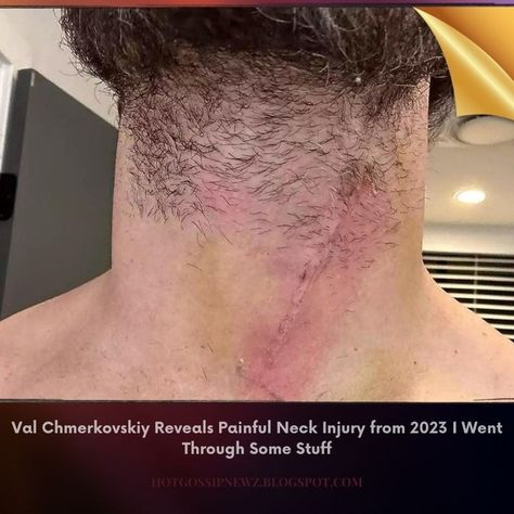 Val Chmerkovskiy Reveals Painful Neck Injury from 2023 I Went Through Some Stuff On Wednesday, the Dancing with the Stars pro, 37, took to Instagram to reflect on a painful neck injury he suffered last year, alongside some photos taken while he was in the hospital. https://hotgossipnewz.blogspot.com/2024/02/val-chmerkovskiy-reveals-painful-neck.html Val Chmerkovskiy, Neck Injury, In The Hospital, Dancing With The Stars, The Hospital, On Wednesday, Dancing, Stars