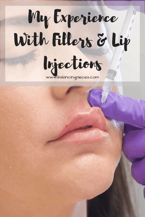 My Experience With Fillers & Lip Injections • Balancing Pieces Bigger Top Lip, Wrinkle Prevention, Overnight Beauty Hacks, Could Be Worse, Beauty Hacks Lips, Overnight Beauty, Injectables Fillers, Lip Filler, First World Problems