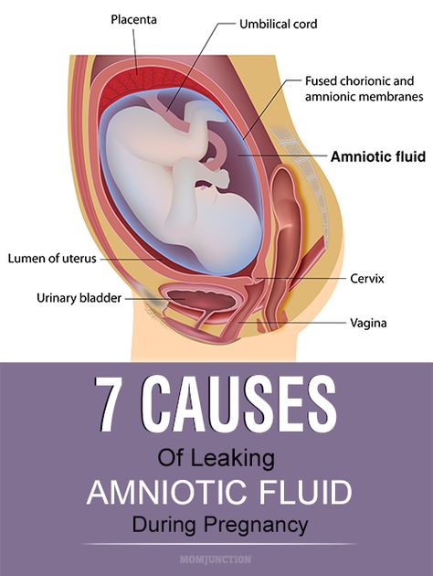 7 Serious Causes Of Leaking Amniotic Fluid During Pregnancy Pregnancy Anatomy, Womens Issues, Color Of Urine, 3rd Trimester Pregnancy, 28 Weeks Pregnant, Pregnancy Checklist, Amniotic Fluid, Gestational Age, Health Guru