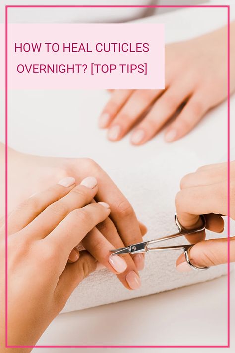 How to Heal Cuticles Overnight! Do you want to know how to heal cracked cuticles, dry cuticles for the best cuticle care! Click to find out more! Heal Cuticles, Infected Cuticle, Healthy Cuticles, Dry Cuticles, Cuticle Cream, Excess Skin, Cuticle Care, Cuticle Remover, Nail Care Routine