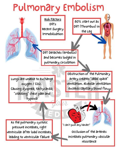 Airway Management Paramedic, Paramedic School Notes, Nremt Study, Paramedic Science, Paramedic Notes, Advanced Emt, Medic School, Paramedic Study, Student Paramedic