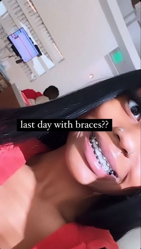 Braces Top Teeth Only, Bright Blue Braces, Gold Braces With Color Bands, Red Power Chain Braces, Silver Braces Black Women, Black Braces Color, Dark Braces Colors, Pink Braces Black Women, Black Braces Power Chain