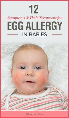 Egg allergy is common in babies whose immune system has not developed to sustain protein content present in it. Know more about egg allergy in babies.  Check out how I got rid of my allergies at https://organicallergyrelief.com/ Egg Allergy Symptoms, Allergy Rash, Baby Food Allergies, Diet Dishes, Egg Allergy, Milk Allergy, Newborn Hacks, Mom Junction, Allergy Symptoms