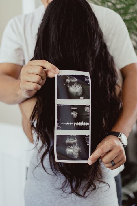 Ultrasound Reveal Pictures, Baby On Board Announcement, Usg Pregnancy Photography, Simple Baby Announcement Picture Ideas, Pregnancy Announcement Photography, Pregnant Announcement, Pregnancy Announcement Pictures, Pregnancy Announcement Photoshoot, Baby Announcement Photoshoot