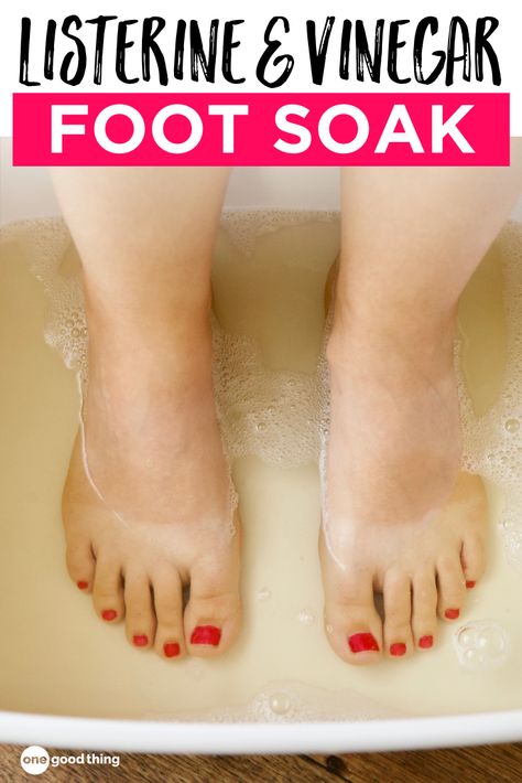 Sometimes the wackiest ideas end up being the most effective, and that is definitely the case with this foot soak! Try it, I dare ya! Vinegar Foot Soak, Listerine Foot Soak, Foot Soak Recipe, Feet Remedies, Antiseptic Mouthwash, Dry Heels, Foot Scrub, Foot Soak, Foot Bath