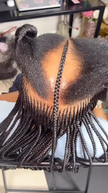 Braids To Cover Bald Spot, Alopecia Hairstyles Black Women Braids, Braids For Women With Alopecia, Braids On Thinning Hair, Traction Alopecia Hairstyles, Braids For Alopecia For Black Women, Alopecia Braid Styles, Alopecia Hairstyles Black Women, Traction Alopecia