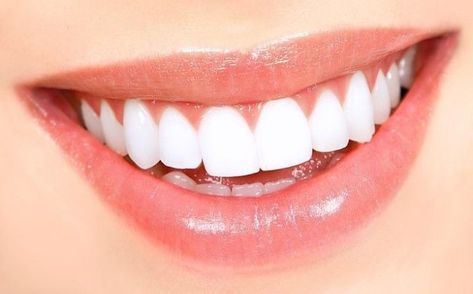 Natural Teeth Whitening Diy, Teeth Whitening Remedies, Teeth Whitening Diy, Beautiful Teeth, Perfect Teeth, Pasta Dental, Dental Veneers, Smile Teeth, Best Teeth Whitening