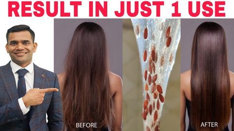 Flaxseed Gel For Hair Growth, Flaxseed Gel For Hair, Diy Flaxseed Gel, Gel For Hair, How To Make Home, Flaxseed Gel, For Hair Growth, Flaxseed, Hair Problems