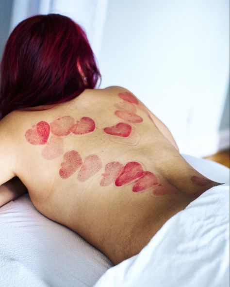 Heart Cupping Therapy, Cupping Aesthetic, Cupping Massage Pictures, Abdominal Cupping Therapy, Hijama Cupping Therapy Quotes, Valentine Massage, Valentine Day Massage, Holistic Massage, Social Pictures