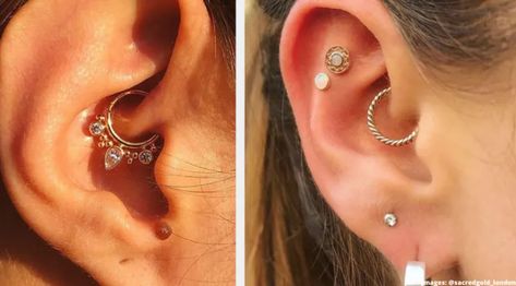 Daith Piercing Migraine, Migraine Piercing, Upper Lip Piercing, Nose Piercing Hoop, Face Piercings, Daith Piercing, Upper Lip, Nose Hoop, Lip Piercing