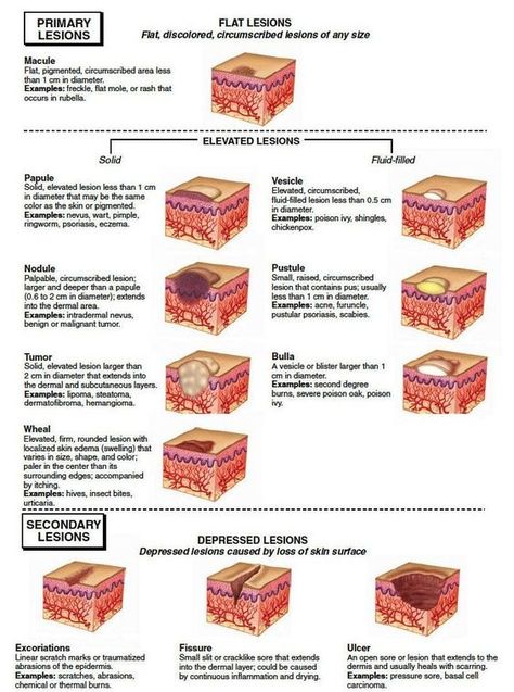 Medically Related Anatomy Notes, Wound Care Nursing, Medical Assistant Student, Medical Esthetician, Nursing Information, Nursing Assessment, Integumentary System, Basic Anatomy And Physiology, Nursing School Survival