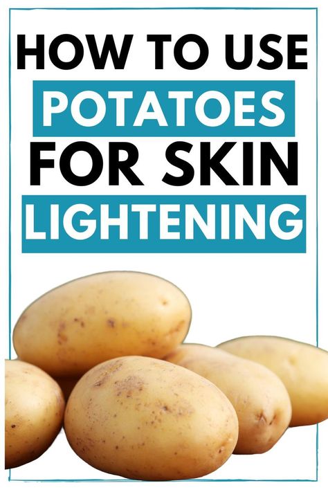 Potatoes are best for skin lightening. The best part is that this home remedy is suitable for all skin types. This post includes a potato bleach for skin whitening, potato whitening cream, potato juice for skin whitening, potato face mask for lightening skin, Learn how to use potato juice for skin brightening. #potato #diyskincare #beautyhacks #diy #skinwhitening #naturalskincarehacks Potato Juice For Skin, Potato For Skin, Potato Face Mask, Remedies For Oily Skin, Potato Face, Benefits Of Potatoes, Juice For Skin, Natural Skin Lightening, Potato Juice