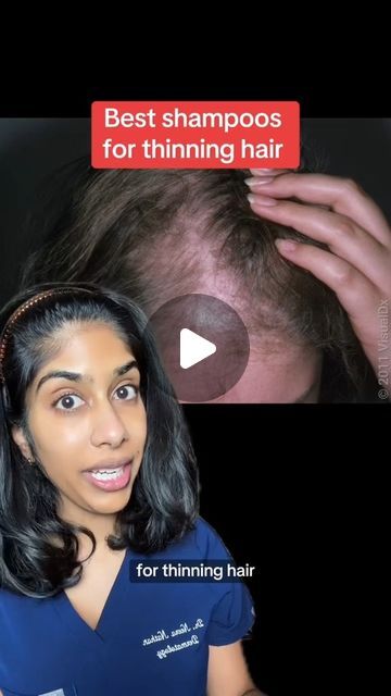 Dr. Neera on Instagram: "Best shampoos for thinning hair. #hairgrowth #hairthinning #hairloss #dermatologist" Hair Products For Thinning Hair, Best Shampoos For Thinning Hair, Best Shampoo For Loss Of Hair, Best Shampoo For Hair Growth, Shampoos For Hair Growth, Best Shampoo For Thinning Hair, Best Shampoo For Women, Thinning Hair Women, Shampoos For Thinning Hair