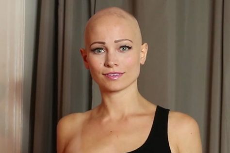 Woman who hid her alopecia from her boyfriend by sleeping in wigs for six months finally revealed her bald head on Facebook after getting sick of ‘keeping it a secret’ – The Sun Women With Alopecia, Frontal Fibrosing Alopecia, Bald Hairstyles For Women, Shiny Bald Head, Funny Bald People Memes, Female Pattern Baldness, Bald Patches, Shave Her Head, Shaved Head Women