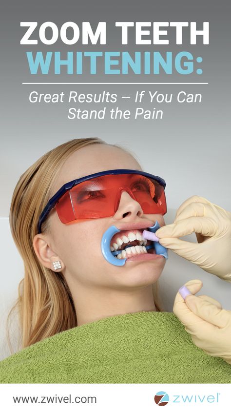 Wellness Consultant, Cheek Retractor, Zoom Teeth Whitening, Zoom Whitening, Teeth Whitening Procedure, Teeth Whitening Remedies, Teeth Whitening Diy, Laser Teeth Whitening, Charcoal Teeth Whitening