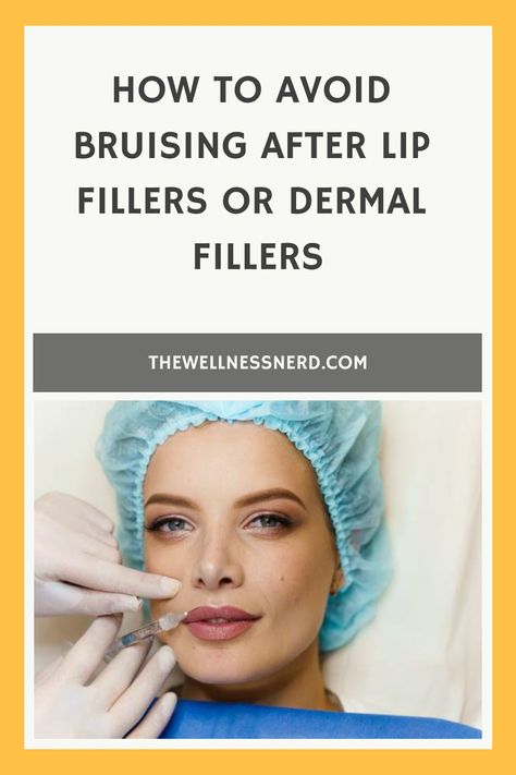 Are you planning on getting injectable fillers? One of the most common side effects of these can be bruising but a few simple changes to your routine before your lip filler appointment, or afterwards, can help reduce the risk of bruises. Whether you're having lip fillers or dermal fillers, read this before your next appointment. After Lip Fillers, Reduce Bruising, Injectables Fillers, Lip Filler, Dermal Fillers, Lip Fillers, Evening Primrose, Workout Aesthetic, Sounds Good