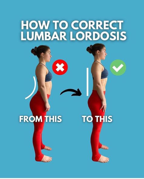 Halona Yoga on Instagram: “If the curve at the lower back arches too far inward, it's known as lumbar lordosis 4 yoga poses to prevent swayback posture // Lordoz…” Lumbar Lordosis, Severe Lower Back Pain, Yoga Daily, Daily Progress, Yoga Burn, Lower Back Exercises, Neck Pain Relief, Lower Back Pain, Yoga Everyday