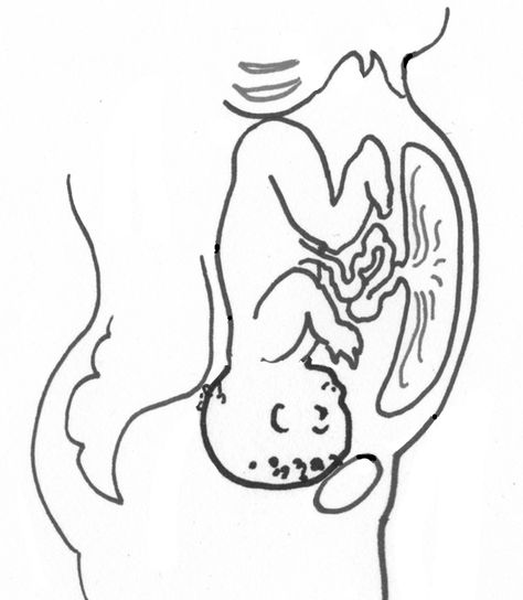 An anterior placenta is a placenta located on the front of the uterus. Most of your sensations of baby's small limb movements may be hidden behind the placenta. Here is the effect of an anterior placenta on fetal positioning! #Pregnancy #Placenta #Childbirth Anterior Placenta, Pregnancy Due Date, Spinning Babies, Baby Gender Prediction, Natural Childbirth, Gender Prediction, Fetal Position, Baby Wishlist, Pregnancy Labor