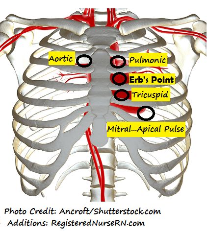 Chest Assessment Nursing (Heart and Lungs) Health Assessment Nursing, Cardiac Assessment, Assessment Nursing, Nursing Planner, Nursing School Life, Nurse Teaching, Nurse Things, Lung Cleanse, Medical Assistant Student