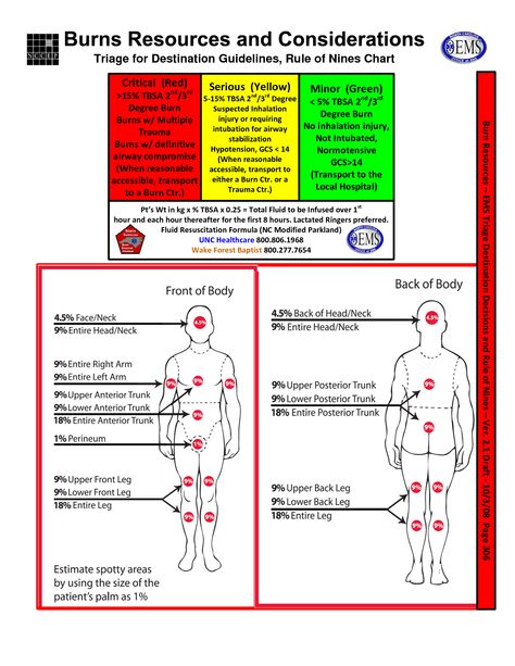 rule of 9's (Burns) Rule Of 9 Burns, Burns Nursing, Anatomy Studying, Medical Office Assistant, Nursing Tools, Emt Study, Nclex Tips, Paramedic School, Nurse Educator