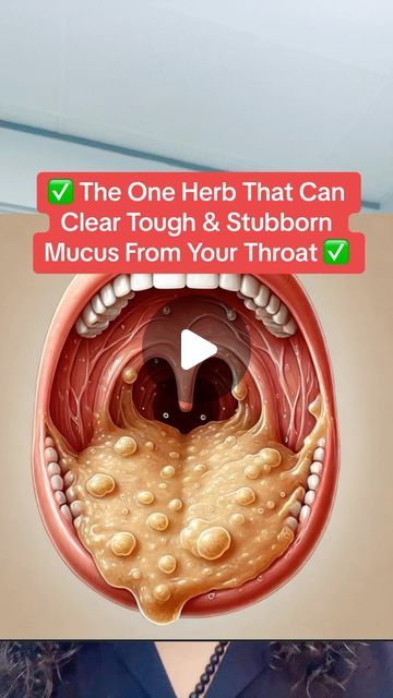 Raw (Mourab) Maraby on Instagram: "✅The One Herb That Can Clear Tough &
Stubborn Mucus From Your Throat✅ #mucus #drythroat #cough #phlegm" Throat Mucus Remedy, Natural Remedy For Cough And Mucus, Herbs For Sinuses, How To Get Mucus Out Of Throat, Stubborn Cough Remedies, Mucus Relief Remedies How To Get Rid, How To Get Rid Of Mucus In Chest, Chest Infection Remedies, Mucus Relief Remedies