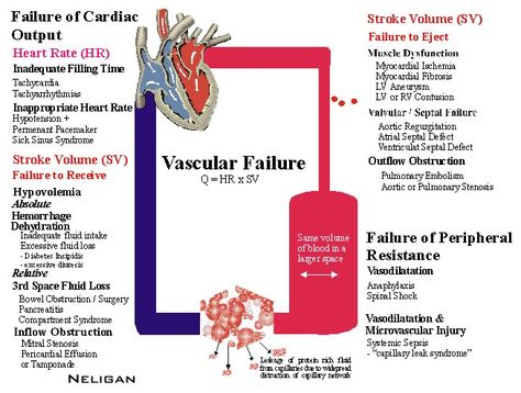 Anesthesia School, Cardiovascular Nursing, Pathophysiology Nursing, Piaggio Liberty, Nursing Study Tips, Nursing Board, 50 Cc, Nursing Mnemonics, Gas Scooter