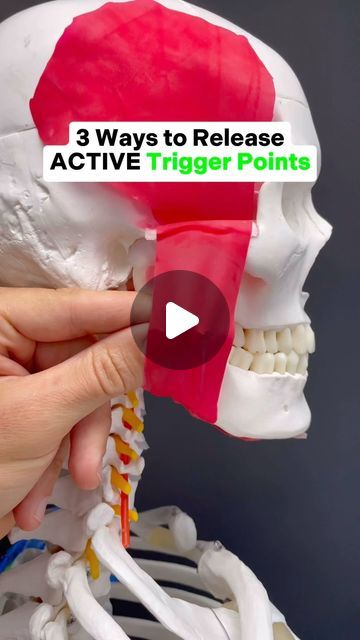 Face Trigger Points, Jaw Massage Trigger Points, Trigger Point Therapy Muscle Knots, Jaw Muscle Release, Tmd Relief, Dry Needling Trigger Points, Tmj Relief Remedies, Jaw Massage, Shoulder Trigger Points