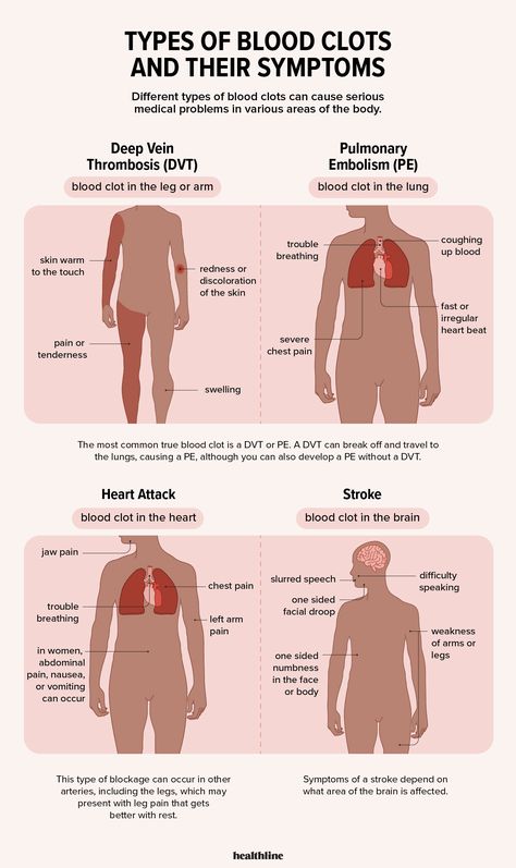 Blood Clot Symptoms: How Do You Know if You Have One? Too Much Estrogen, Normal Blood Pressure, Health And Fitness Magazine, High Blood Sugar, Chest Pain, True Blood, Medical Problems, Blood Vessels, Warning Signs