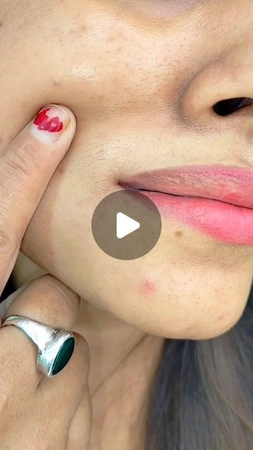 Upper Lip Hair Removal At Home, Face Hair Removal Home Remedies, Face Clean Up At Home, Diy Facial Hair Removal, Face Wrinkles Remedies, Upper Lip Hair Removal, Upper Lips, Hair Removal At Home, Face Diy