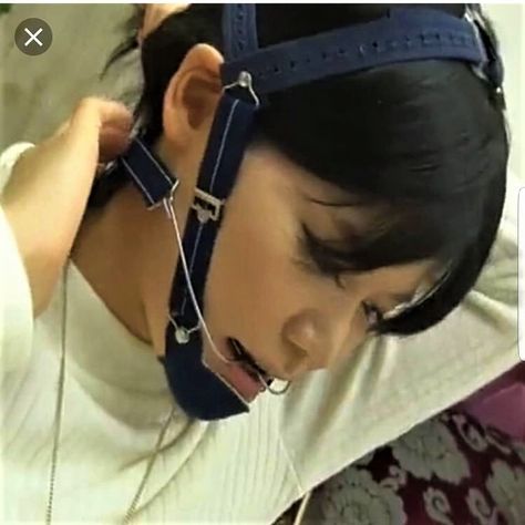 Headgear Braces, Girls With Braces, Braces Girls, Orthodontics Braces, Online Photo, Braces, To The World, Photo Sharing, Photo And Video