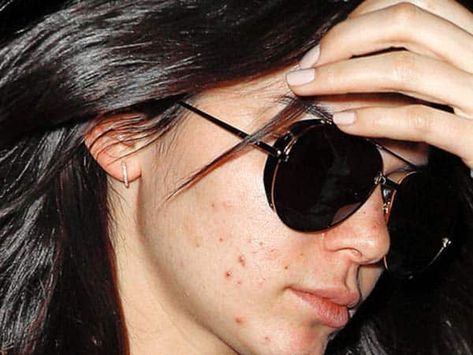 15 Latest Kendall Jenner without Makeup Images | Styles At Life Kendall Jenner No Makeup, Khloe Kardashian Without Makeup, Kendall Jenner Without Makeup, Kendall Makeup, Kendall Jenner Acne, Kim Kardashian Without Makeup, No Makeup Pictures, Models Without Makeup, Kendall Jenner Icons