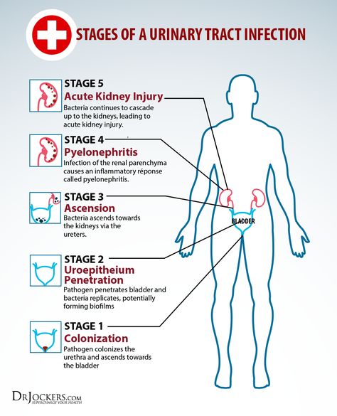 5 Phases to Heal UTIs Naturally - DrJockers.com Bladder Health, Acute Kidney Injury, Kidney Pain, Healthy Remedies, Urinary Health, Natural Antibiotics, Kidney Health, Urinary Tract, Natural Treatments