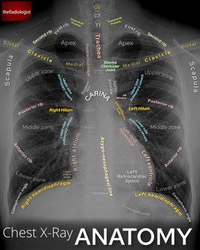 Radiography Student, Medical Radiography, Radiologic Technology, Radiology Student, Radiology Technician, Radiology Imaging, Radiology Tech, Medical Student Study, Medicine Student