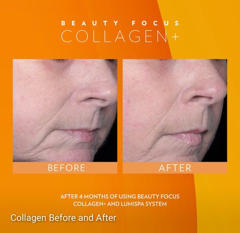 Collagen Plus Nuskin, Beauty Supplements, Collagen Supplements, Top Skin Care Products, Collagen Powder, Gorgeous Skin, Collagen Peptides, Anti Aging Skin Products, Aging Skin Care