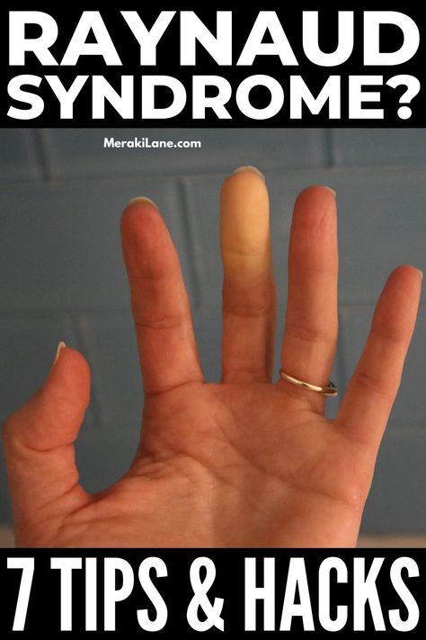 Essential Oils For Raynaud's Syndrome, Reynauds Syndrome Symptoms, Raynauds Disease Remedies, Raynauds Syndrome, Reynauds Syndrome, Reynauds Disease, Autoimmune Disease Symptoms, Bursitis Hip, Healthy Healing