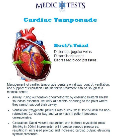 Nremt Study, Cardiac Tamponade, Cardiac System, Respiratory Therapy Notes, Telemetry Nursing, Medical Math, Cardiac Sonography, Emt Study, Nurse Teaching