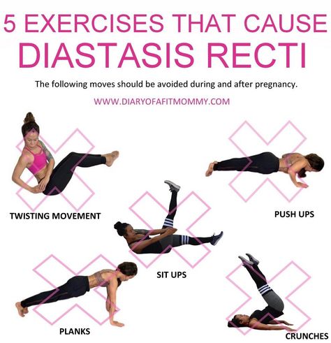 Postpartum Hip Workout, Exercises To Avoid With Diastasis Recti, Diastasis Recti Exercises To Avoid, Workouts For Diastasis Recti, Workout For Diastasis Recti, Workout Diary, Postpartum Exercises, Exercise Poster, Rectus Abdominis