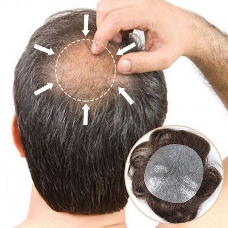 Best Hair Patches Online Cheap Ceiling Ideas, 1960 Chevy Impala, Hairstyles Medium Hair, Mens Toupee, Hair Replacement Systems, Male Pattern Baldness, Bald Hair, Pattern Baldness, Crown Hair