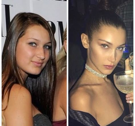 Bella Hadid before and after Bella Hadid Nose, Instagram Vs Real Life, Facial Surgery, Nose Surgery, Celebrity Plastic Surgery, Celebrities Before And After, Lip Injections, Perfect Lips, Nose Job