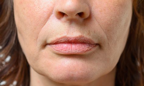 The Best Ways To Get Rid Of Lip Lines and Smooth Lip Wrinkles Chest Wrinkles, Lip Wrinkles, Under Eye Wrinkles, Eye Wrinkle, Facial Exercises, Smooth Lips, How To Line Lips, Sagging Skin, Wrinkle Remover