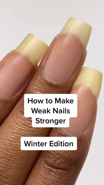 Grow Long Nails, Nail Growth Tips, Grow Nails Faster, Nail Serum, Weak Nails, Gel Acrylic Nails, Nail Care Tips, Nail Care Routine, How To Grow Nails