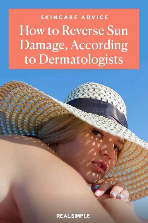 Sun Damage On Face, Sun Spots Removal, Repair Sun Damaged Skin, Damaged Skin Repair, Stop Hair Breakage, Face Peel, Chemical Peels, Best Lotion, Sun Damaged Skin