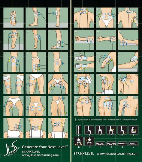 Tens Electrode Placement, Tens Unit Placement, Tens Therapy, Tens And Units, Tens Machine, Tens Unit, Tens Ems, Ten Unit, Massage Therapy