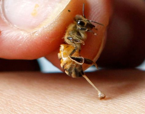 Bee stings hurt, so it seems like an odd proposition to get them on purpose. Believe it or not, the venom that makes that sting may also benefit humans in therapy. Treating Bee Stings, Bee Venom Therapy, Remedies For Bee Stings, Wasp Stings, Bee Removal, Bee Venom, Bee Sting, Bee Friendly, Bee Pollen