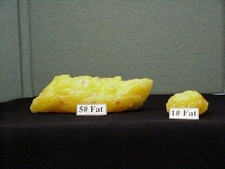 This is what 1lb and 5lb of fat look like.  Be grateful for every pound lost! 5 Lbs Of Fat, One Pound Of Fat, Lose 5 Pounds, Pound Of Fat, Migraine Headaches, Quick Healthy, Lose 20 Pounds, Migraine, Fitness Nutrition