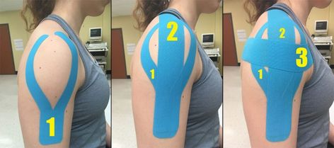 Kinesio Taping Shoulder, Rotator Cuff Injury Exercises, Rotator Cuff Rehab, Physio Tape, Rotator Cuff Pain, Shoulder Rehab Exercises, Rotator Cuff Exercises, K Tape, Shoulder Rehab