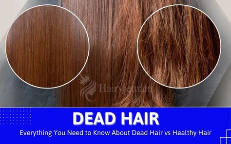 Dead Hair vs Healthy Hair Dead Ends Hair, Zombie Hair, Fried Hair, Dead Hair, Vibrant Hair, Talcum Powder, Hair Help, Dull Hair, Daily Habits