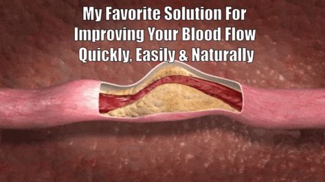 Best Exercises For Increasing Blood Flow & Circulation To Your Legs & Extremities | Dr. Sam Robbins Circulation Remedies, Foods That Contain Calcium, Blood Circulation Remedies, Cleansing Foods, Clean Arteries, Hdl Ldl, Erectile Dysfunction Remedies, Calcium Deposits, Increase Blood Flow