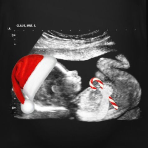 Lol if I have babies one day I'd totally get this!!! #sonographer Baby Announcement Christmas Card, Baby Announcement Christmas, Christmas Baby Announcement, Baby Boy Announcement, Glad Tidings, Christmas Pregnancy Announcement, Christmas Pregnancy, New Baby Announcements, Foto Baby