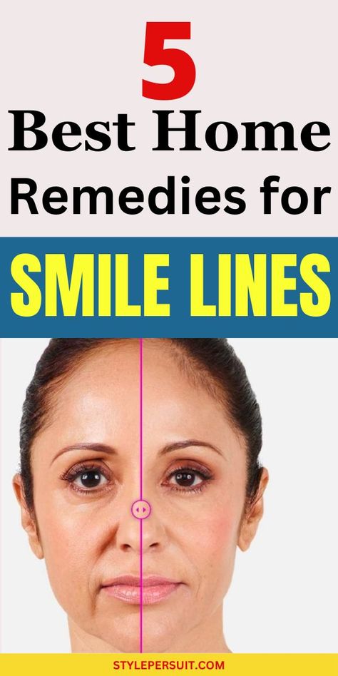 Smile lines, also known as laugh lines or nasolabial folds, are the creases that form around the mouth and nose as a natural part of aging. While they're a testament to a life filled with joy and laughter, some people may feel self-conscious about them and seek ways to minimize their appearance. While completely getting rid of smile lines may not be possible, there are several strategies to reduce their prominence and keep your skin looking youthful and vibrant. Lines Around Mouth, Mouth Wrinkles, Laugh Lines, Dark Underarms, Smile Lines, Nasolabial Folds, Anti Aging Eye Cream, Face Lines, Luxury Cosmetics